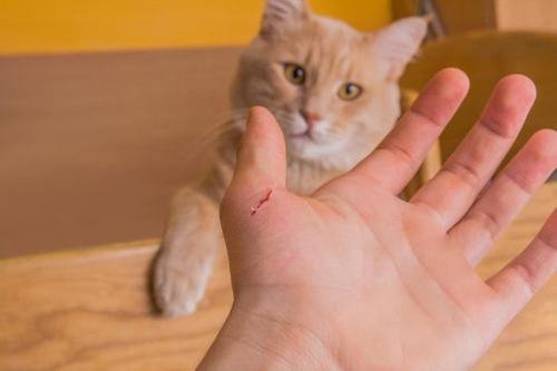 猫抓病.jpg